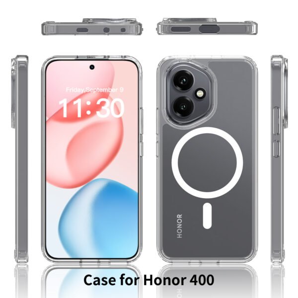 Honor 400 - Magnetic Anti-Scratch Protection